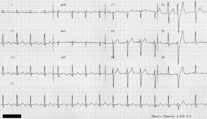 Geriatric- Cardiology Record